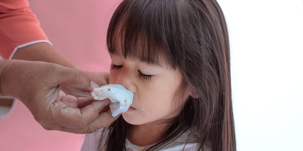 penyebab mimisan pada anak