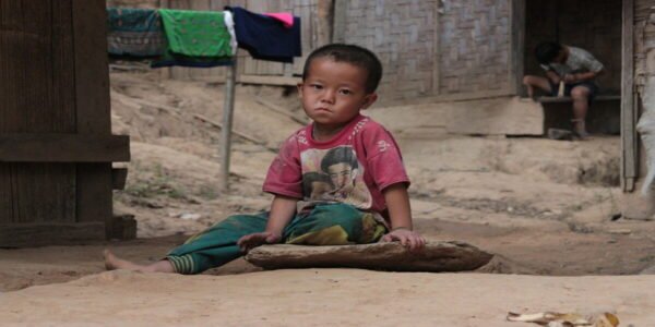 Gizi buruk pada anak