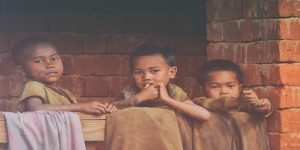Penyebab Malnutrisi