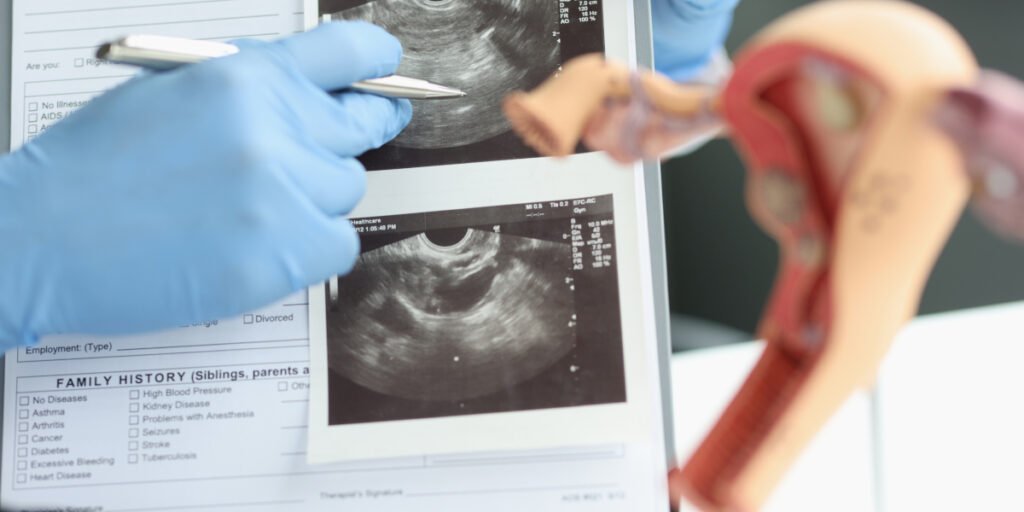 fungsi usg transvaginal