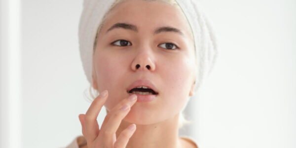 Cara mengatasi bibir kering dan mengelupas