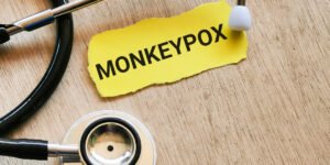 monkey pox
