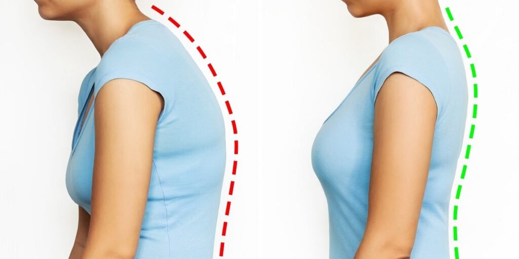Pectus Excavatum Adalah