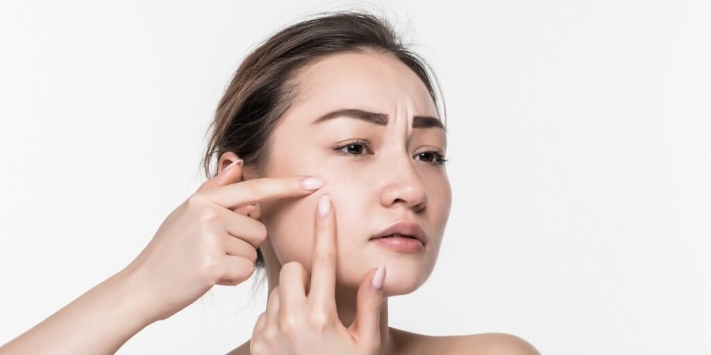 cara menghilangkan bintik putih di wajah