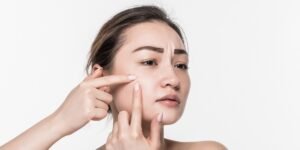 cara menghilangkan bintik putih di wajah