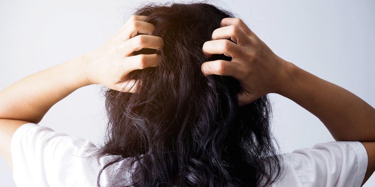 cara menghilangkan kutu rambut