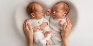 bayi kembar siam