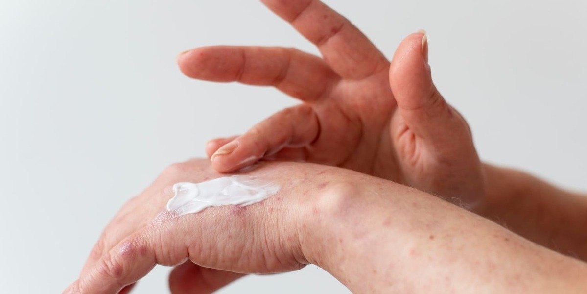 kloderma obat apa