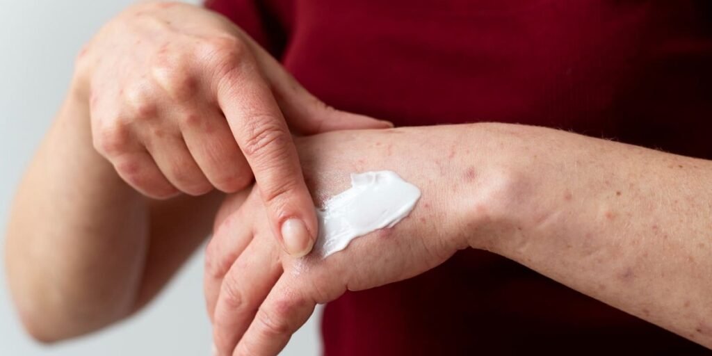 oviskin obat apa