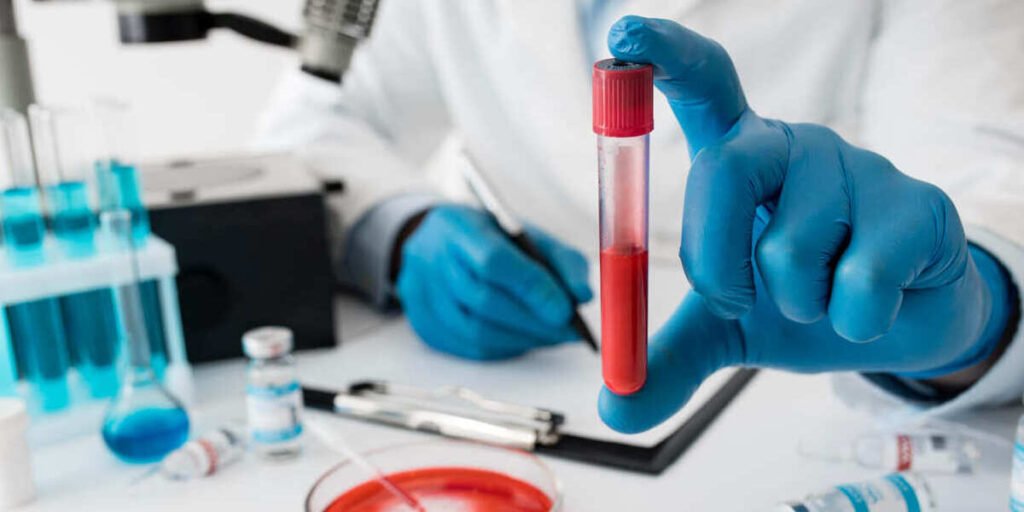 thalasemia mayor