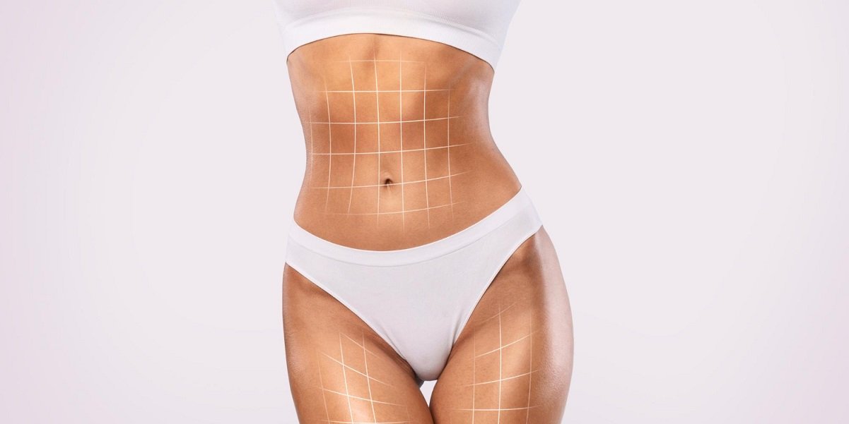 mengenal liposuction manfaat efek samping