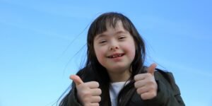 apa itu down syndrome